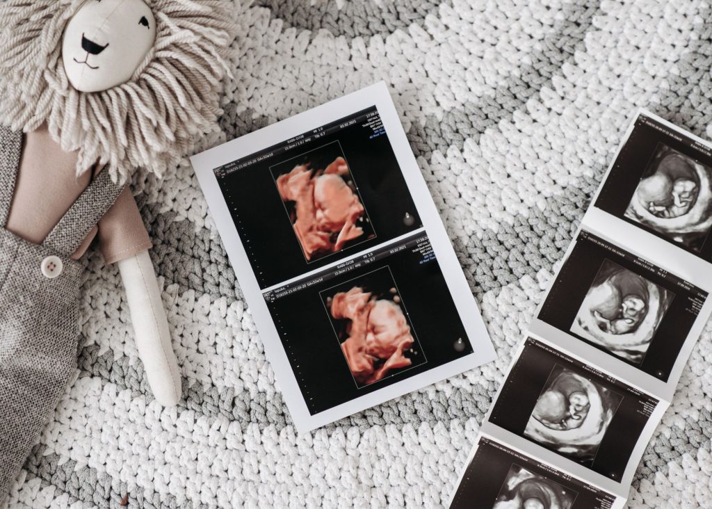 cuando-hacer-ecografia-5d